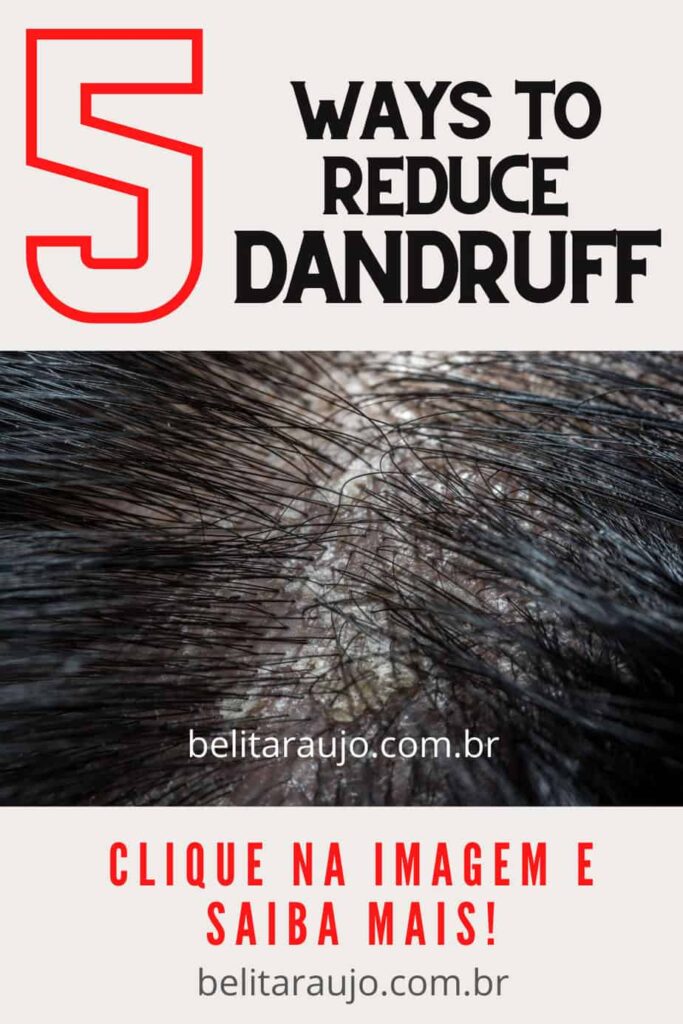 5 Ways to Reduce Dandruff