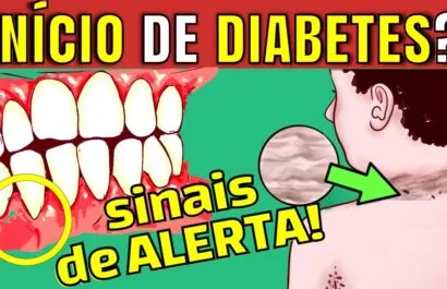 7 SINAIS QUE SEU CORPO DÁ QUE O AÇÚCAR DO SANGUE ESTÁ MUITO ALTO (sintomas iniciais de diabetes)